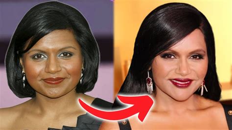 Mindy Kaling Plastic Surgery: The Truth Behind All Speculations